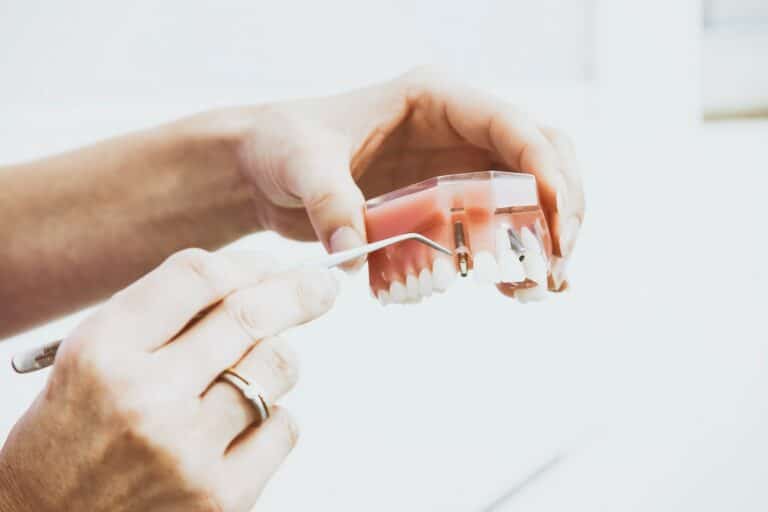 All Pros and Cons of Dental Implants