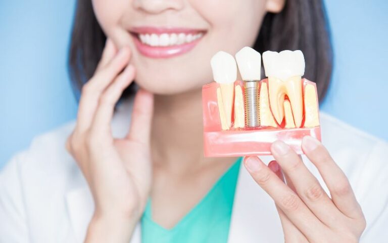 Explained: How Do Dental Implants Really Work?