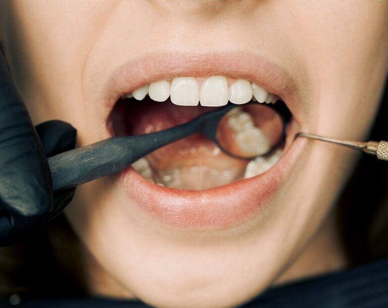 When would you need a dental crown. Six symptoms to keep an eye on.